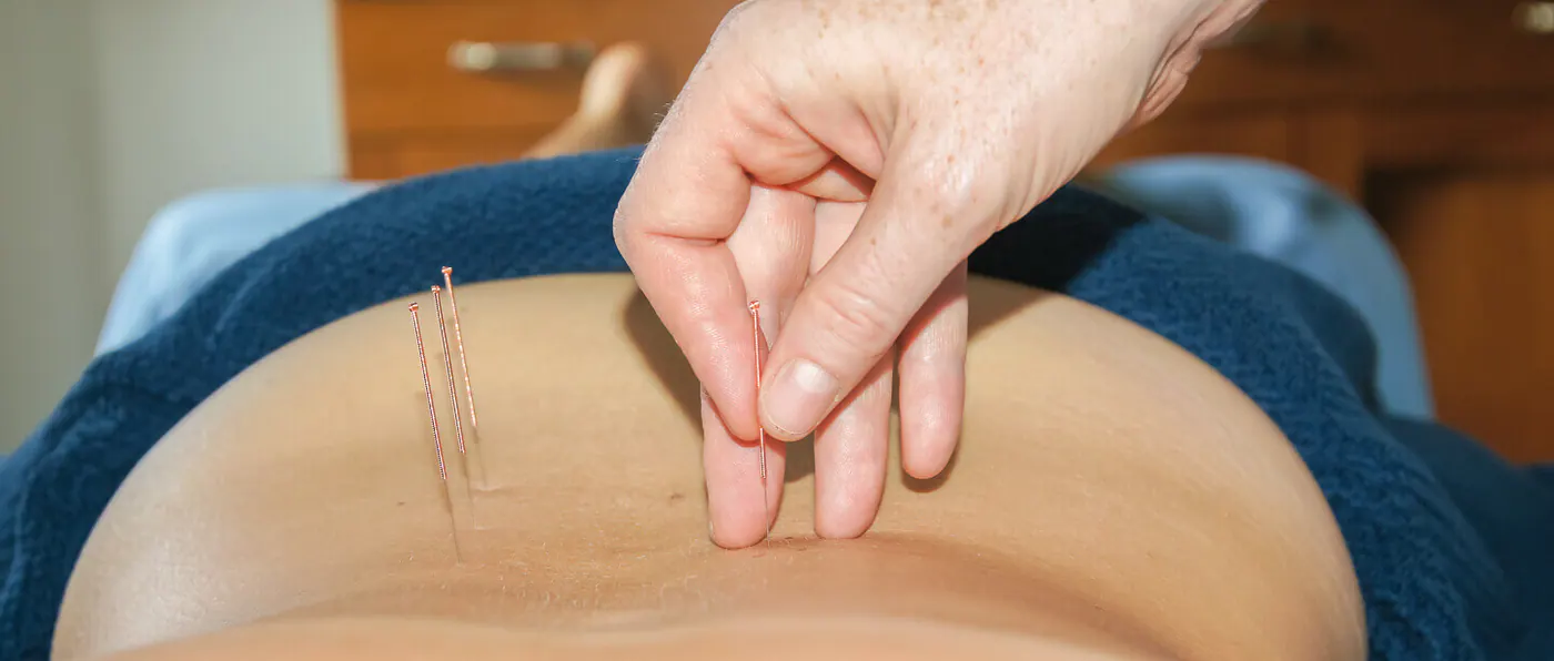 Séance d’acupuncture à Boddhi Clinic